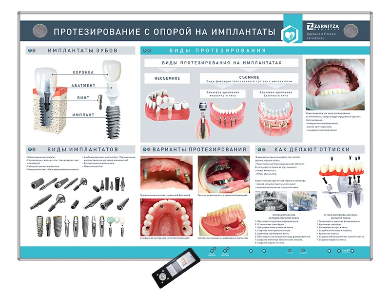 Стенд Зарница протезирование с опорой на имплантаты